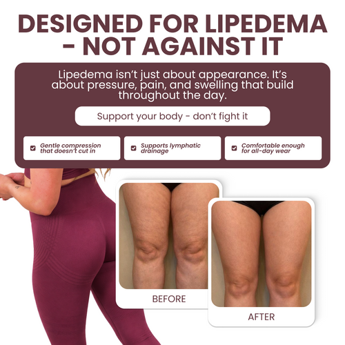 Limosia 3D Graduated Compression Leggings (BOGO)