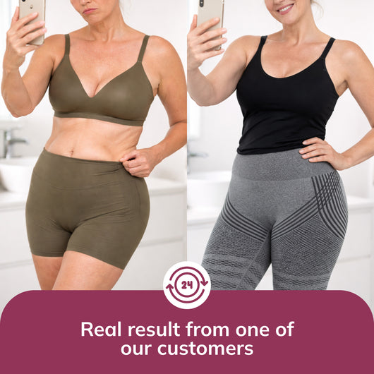 Limosia 3D Graduated Compression Leggings Lipedema