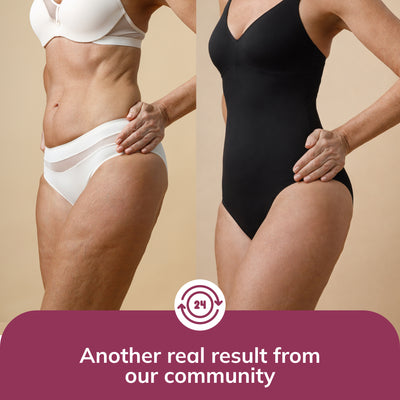 Limosia 3D Graduated Compression Leggings Lipedema