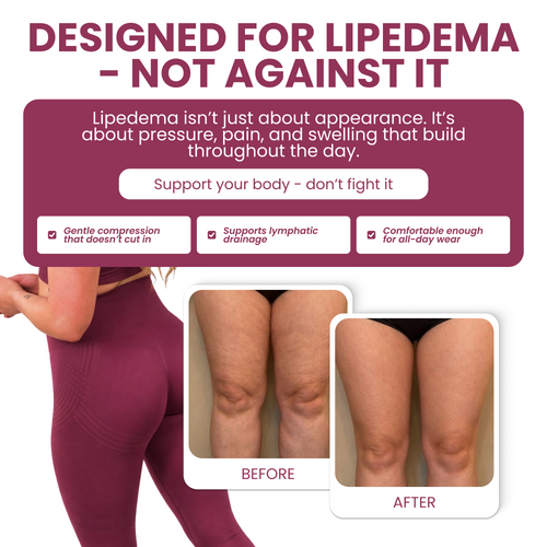 Limosia 3D Graduated Compression Leggings For RLS